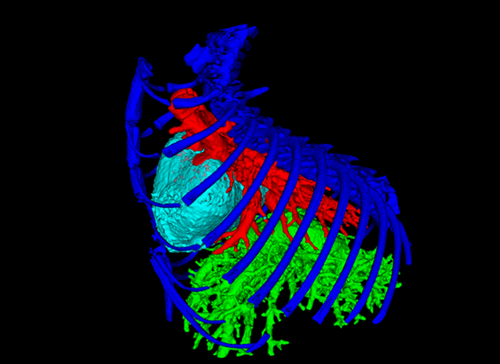 Image of a scan of a chest cavity